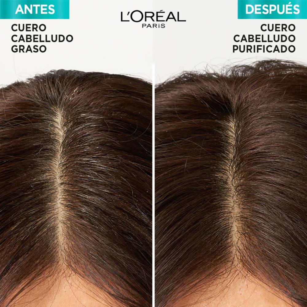 Shampoo Capilar Hialurónico Pure Para Raíz Grasa Y Puntas Deshidratadas ELVIVE L'ORÉAL 680 Ml - Imagen 3